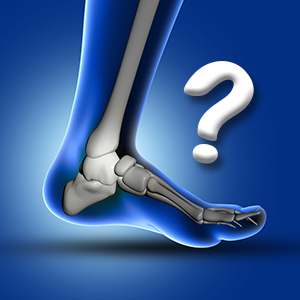 Joint Quiz Joint Quiz